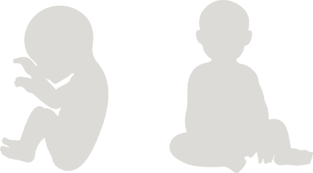 Chart depicting Alexanders disease symptoms with early onset on the left, and late onset on the right.