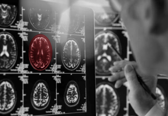 A man reviews a wall of brain scans with one highlighted in red.